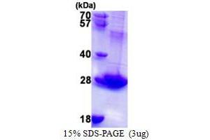 SDS-PAGE (SDS) image for RAB3B, Member RAS Oncogene Family (RAB3B) (AA 1-219) protein (His tag) (ABIN667488) (RAB3B Protein (AA 1-219) (His tag))
