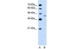 WB Suggested Anti-DHODH  Antibody Titration: 0.
