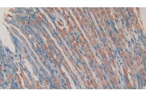 Detection of CHEM in Mouse Stomach Tissue using Polyclonal Antibody to Chemerin (CHEM) (Chemerin antibody  (AA 21-155))