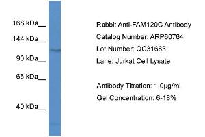 Western Blotting (WB) image for anti-Family with Sequence Similarity 120C (FAM120C) (N-Term) antibody (ABIN2788566) (FAM120C antibody  (N-Term))