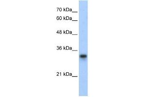 RPL8 antibody used at 0. (RPL8 antibody  (C-Term))