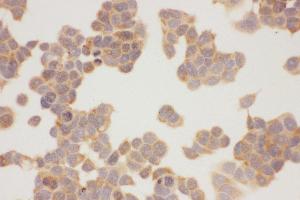 Immunohistochemistry (IHC) image for anti-Heat Shock Protein 90kDa alpha (Cytosolic), Class A Member 1 (HSP90AA1) (AA 2-365) antibody (ABIN3043847)