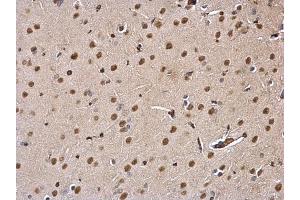 IHC-P Image DDB1 antibody detects DDB1 protein at nucleus and cytosol on rat fore brain by immunohistochemical analysis. (DDB1 antibody  (C-Term))