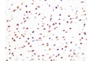 Immunohistochemistry (IHC) image for anti-Protein Arginine Methyltransferase 1 (PRMT1) antibody (ABIN7269604)