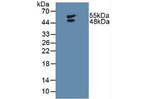 Detection of LTbR in Human U-87MG Cells using Polyclonal Antibody to Lymphotoxin Beta Receptor (LTbR)