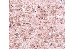 Immunohistochemistry (IHC) image for anti-Zinc Finger and BTB Domain Containing 1 (ZBTB1) (Middle Region) antibody (ABIN1031169) (ZBTB1 antibody  (Middle Region))