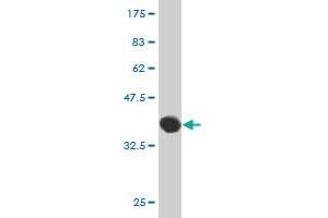 Western Blot detection against Immunogen (36.