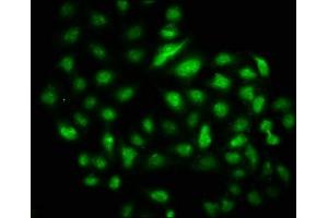 Immunofluorescence staining of Hela cells with ABIN7150197 at 1:133, counter-stained with DAPI. (DMAP1 antibody  (AA 250-300))