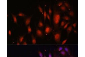 Immunofluorescence analysis of NIH/3T3 cells using TFEB Polyclonal Antibody at dilution of 1:100. (TFEB antibody)