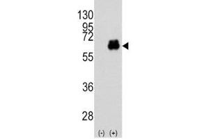 Western blot analysis of Myc antibody and 293 cell lysate (2 ug/lane) either nontransfected (Lane 1) or transiently transfected with the MYC gene (2). (c-MYC antibody  (AA 36-65))