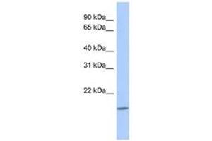 Image no. 1 for anti-C-Type Lectin-Like 1 (CLECL1) (N-Term) antibody (ABIN6741239) (CLECL1 antibody  (N-Term))