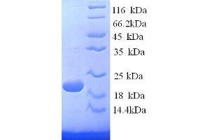 SDS-PAGE (SDS) image for Interferon gamma (IFNG) (AA 24-166) protein (His tag) (ABIN7479106)