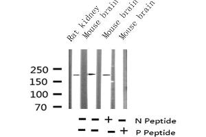 Western blot analysis of Phospho-Tuberin/TSC2 (Thr1462) Antibody expression in mouse brain and rat kidney tissues lysates.
