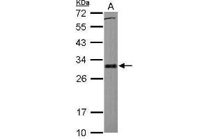 WB Image Sample (30 ug of whole cell lysate) A: HCT116 12% SDS PAGE antibody diluted at 1:1000 (BCL2L1 antibody)