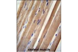 INB antibody (C-term) (ABIN654447 and ABIN2844181) immunohistochemistry analysis in formalin fixed and paraffin embedded human skeletal muscle followed by peroxidase conjugation of the secondary antibody and DAB staining. (INPP5B antibody  (C-Term))