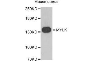 Western blot analysis of extracts of Mouse uterus, using MYLK antibody. (MYLK antibody)