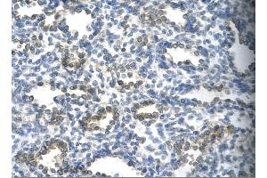 Rabbit Anti-SUV39H1 Antibody       Paraffin Embedded Tissue:  Human alveolar cell   Cellular Data:  Epithelial cells of renal tubule  Antibody Concentration:   4. (SUV39H1 antibody  (C-Term))