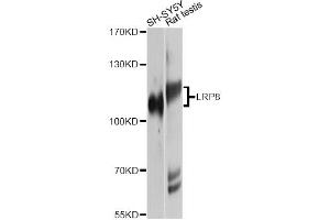 Western blot analysis of extracts of various cell lines, using LRP8 Antibody. (LRP8 antibody)