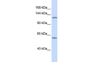 WB Suggested Anti-PHF12 Antibody Titration:  0.
