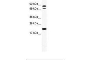 Image no. 1 for anti-Zinc Finger Protein 287 (ZNF287) (AA 104-153) antibody (ABIN202903) (ZNF287 antibody  (AA 104-153))