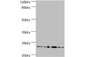 Western blot All lanes: Fxn antibody at 2 μg/mL Lane 1: HepG2 whole cell lysate Lane 2: Hela whole cell lysate Lane 3: Mouse brain tissue Lane 4: Jurkat whole cell lysate Secondary Goat polyclonal to rabbit IgG at 1/10000 dilution Predicted band size: 23 kDa Observed band size: 23 kDa (Frataxin antibody  (AA 78-207))