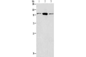 Gel: 8 % SDS-PAGE, Lysate: 40 μg, Lane 1-3: Hela cells, Jurkat cells, NIH/3T3 cells, Primary antibody: ABIN7128400(ANAPC2 Antibody) at dilution 1/200, Secondary antibody: Goat anti rabbit IgG at 1/8000 dilution, Exposure time: 40 seconds (ANAPC2 antibody)