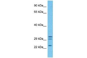 Host:  Rabbit  Target Name:  PGRC2  Sample Type:  Fetal Lung lysates  Antibody Dilution:  1ug/ml (PGRMC1 antibody  (C-Term))