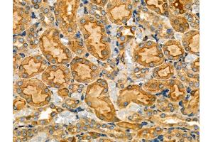 ABIN6257018 and ABIN6274200 at 1/100 staining Rat kidney tissue by IHC-P. (PRKACG antibody  (N-Term))