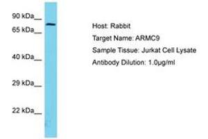 Image no. 1 for anti-Armadillo Repeat Containing 9 (ARMC9) (AA 90-139) antibody (ABIN6750691) (ARMC9 antibody  (AA 90-139))