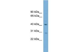 WB Suggested Anti-HAPLN4 Antibody Titration:  0.