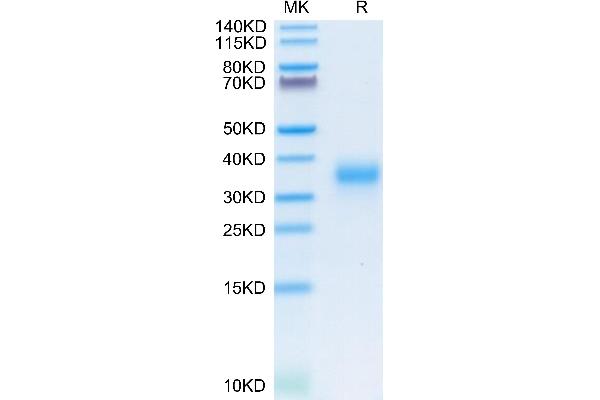 CD74 Protein (AA 73-232) (His tag)