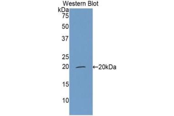 CFP antibody  (AA 315-469)