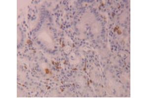 IHC-P analysis of Human Stomach Tissue, with DAB staining. (FLG2 antibody  (AA 1222-1368))
