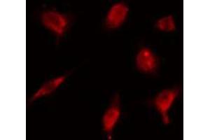 ABIN6274179 staining HeLa cells by IF/ICC. (ZNF18 antibody  (C-Term))
