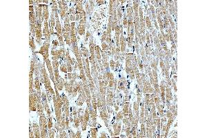 IHC analysis of NKX2-5 using anti-NKX2-5 antibody (ABIN7600098).