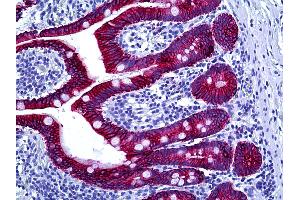 Anti-Cytokeratin Type II antibody IHC of human intestine. (Keratin Basic antibody)