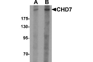 Western blot analysis of CHD7 in SK-N-SH cell lysate with CHD7 antibody at (A) 1 and (B) 2 µg/mL. (CHD7 antibody  (N-Term))