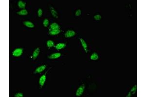 Immunofluorescent analysis of Hela cells using ABIN7173949 at dilution of 1:100 and Alexa Fluor 488-congugated AffiniPure Goat Anti-Rabbit IgG(H+L) (TWIST2 antibody  (AA 1-70))