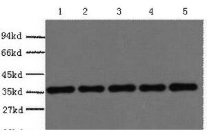 Western Blot analysis of 293T, Rat brain, NIH, 3T3, Sheep muscle, Rabbit testis using GAPDH Polyclonal Antibody at dilution of 1:5000. (GAPDH antibody)