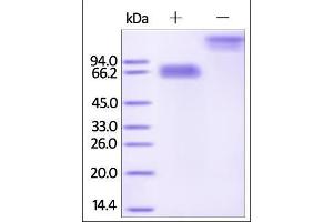 SDS-PAGE (SDS) image for Mesothelin (MSLN) (AA 296-580) (Active) protein (Fc Tag) (ABIN2181518)