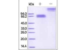 Human Mesothelin (aa 296-580), Fc Tag on SDS-PAGE under reducing (R) and no-reducing (NR) conditions. (Mesothelin Protein (MSLN) (AA 296-580) (Fc Tag))