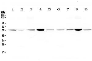 Western blot analysis of Glutathione Reductase using anti-Glutathione Reductase antibody . (Glutathione Reductase antibody  (AA 256-522))