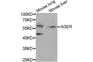Western blot analysis of extracts of various tissues, using AGER antibody. (RAGE antibody  (AA 30-330))