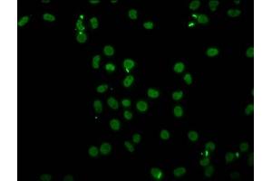 Immunofluorescence staining of Hela cells (treated with 30mM sodium butyrate for 4h) with ABIN7139206 at 1:5, counter-stained with DAPI. (HIST1H4A antibody  (acLys91))