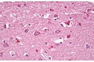 Image no. 2 for anti-Ras Homolog Family Member G (RHOG) (AA 112-161) antibody (ABIN6749774) (RHOG antibody  (AA 112-161))