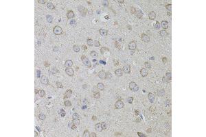 Immunohistochemistry of paraffin-embedded mouse brain using CD59 antibody. (CD59 antibody)