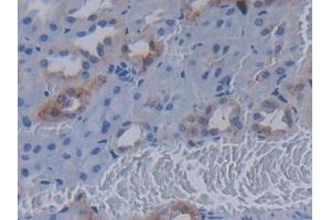 Immunohistochemistry (IHC) image for anti-Mucin 20, Cell Surface Associated (MUC20) (AA 113-347) antibody (ABIN7429004)