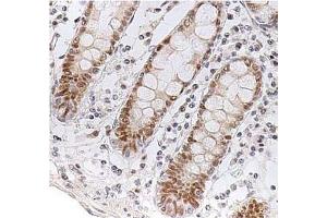 Immunohistochemistry (IHC) image for anti-Checkpoint Kinase 2 (CHEK2) antibody (ABIN487312) (CHEK2 antibody)