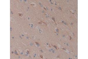 Used in DAB staining on fromalin fixed paraffin- embedded Kidney tissue (C10orf2 antibody  (AA 384-635))