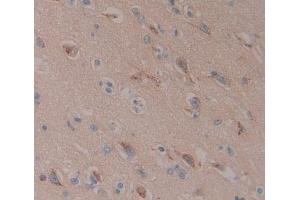 Used in DAB staining on fromalin fixed paraffin- embedded Kidney tissue